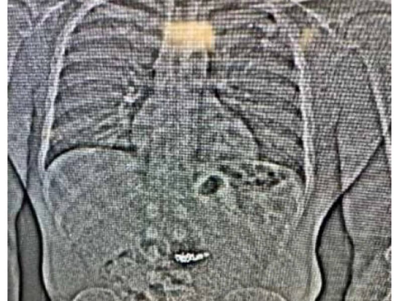 Man Arrested After Swallowing Stolen Tiffany & Co. Jewellery Worth Over $700,000